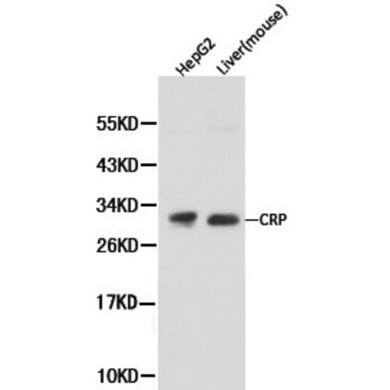 Anti-CRP Antibody from Bioworld Technology (BS6484) - Antibodies.com