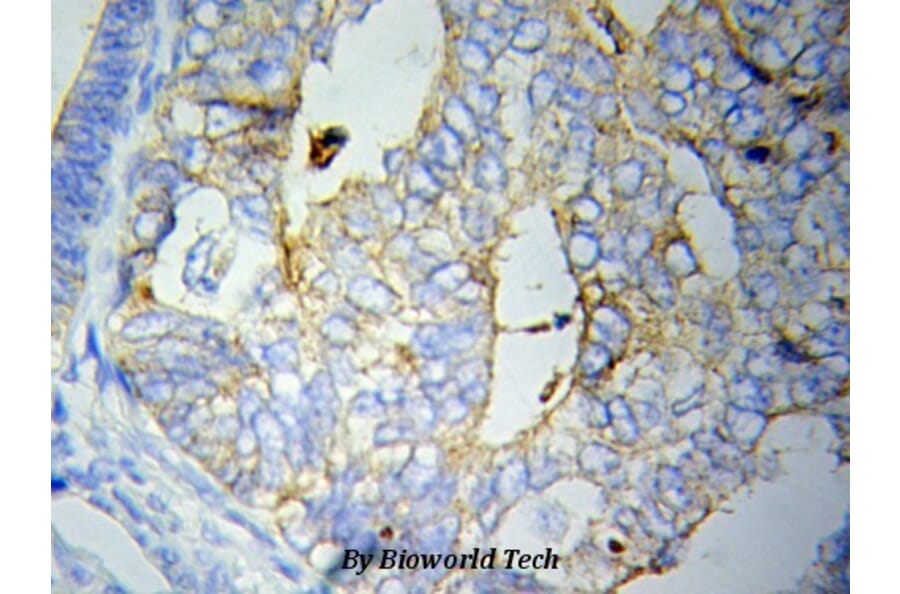 Anti-CRP Antibody from Bioworld Technology (BS6484) - Antibodies.com