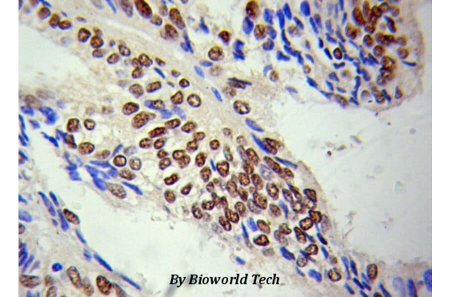 Anti-HDAC1 Antibody from Bioworld Technology (BS6485) - Antibodies.com