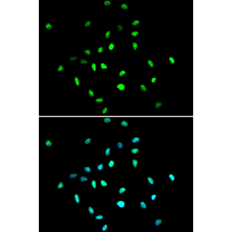 Anti-HDAC1 Antibody from Bioworld Technology (BS6485) - Antibodies.com