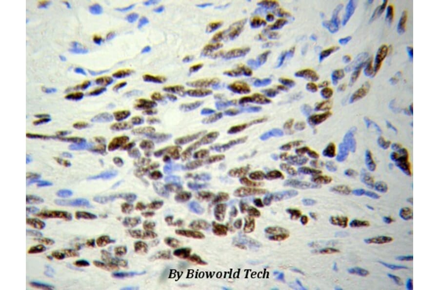Anti-HDAC4 Antibody from Bioworld Technology (BS6486) - Antibodies.com