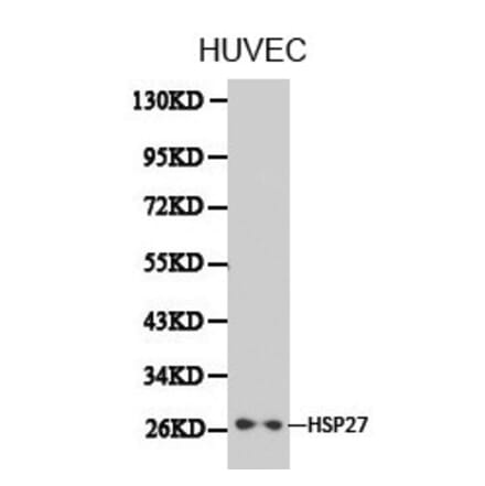 Anti-HSP27 Antibody from Bioworld Technology (BS6487) - Antibodies.com