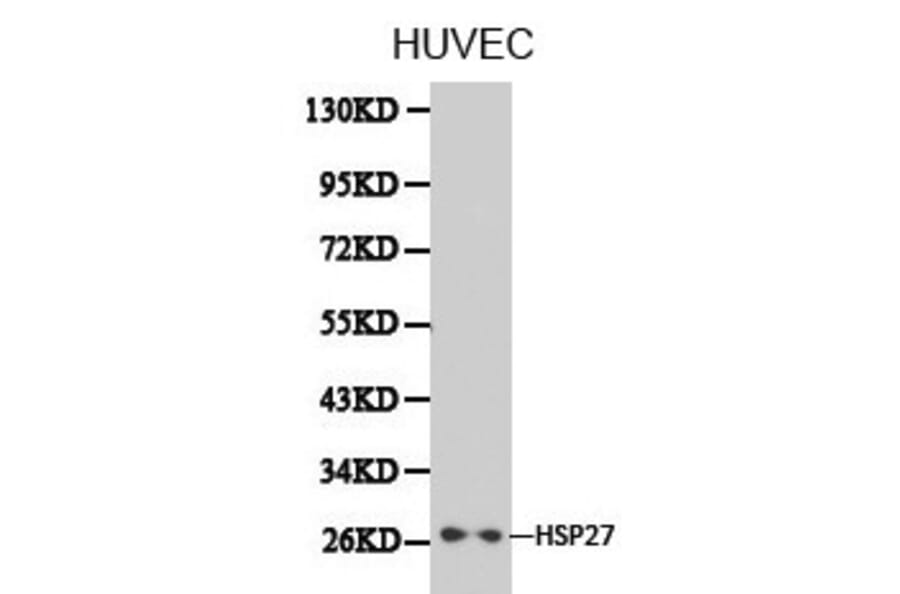 Anti-IKBKE Antibody from Bioworld Technology (BS6488) - Antibodies.com