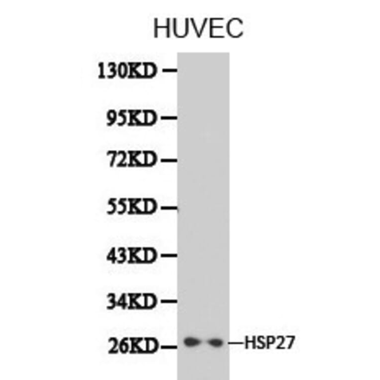 Anti-IKBKE Antibody from Bioworld Technology (BS6488) - Antibodies.com