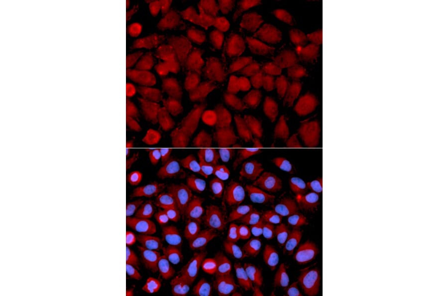 Anti-JNK2 Antibody from Bioworld Technology (BS6489) - Antibodies.com