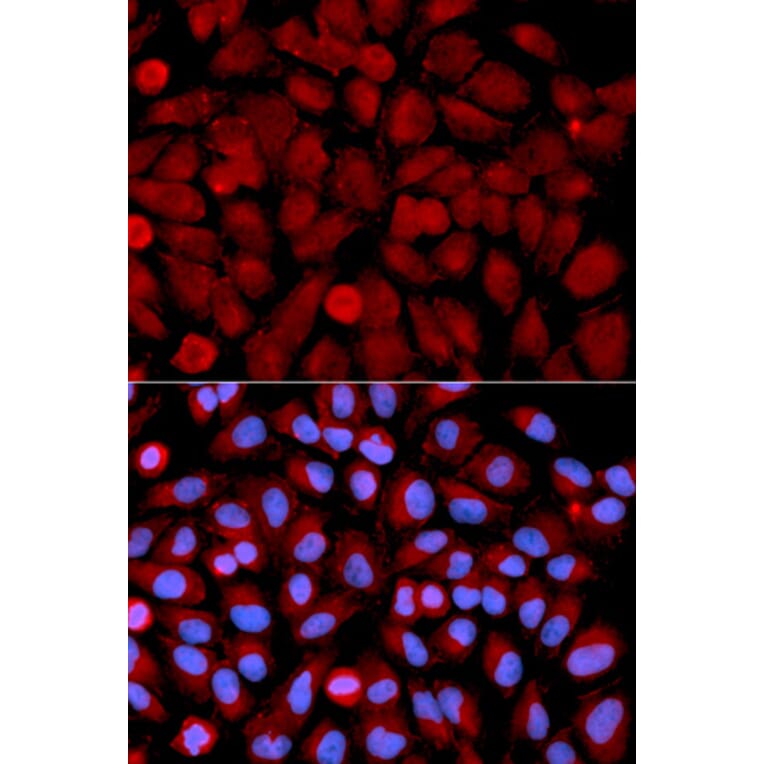 Anti-JNK2 Antibody from Bioworld Technology (BS6489) - Antibodies.com