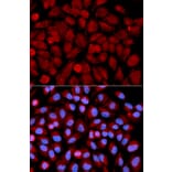 Anti-JNK2 Antibody from Bioworld Technology (BS6489) - Antibodies.com