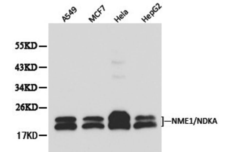 Anti-NM23-H1 (NDKA) Antibody from Bioworld Technology (BS6492) - Antibodies.com