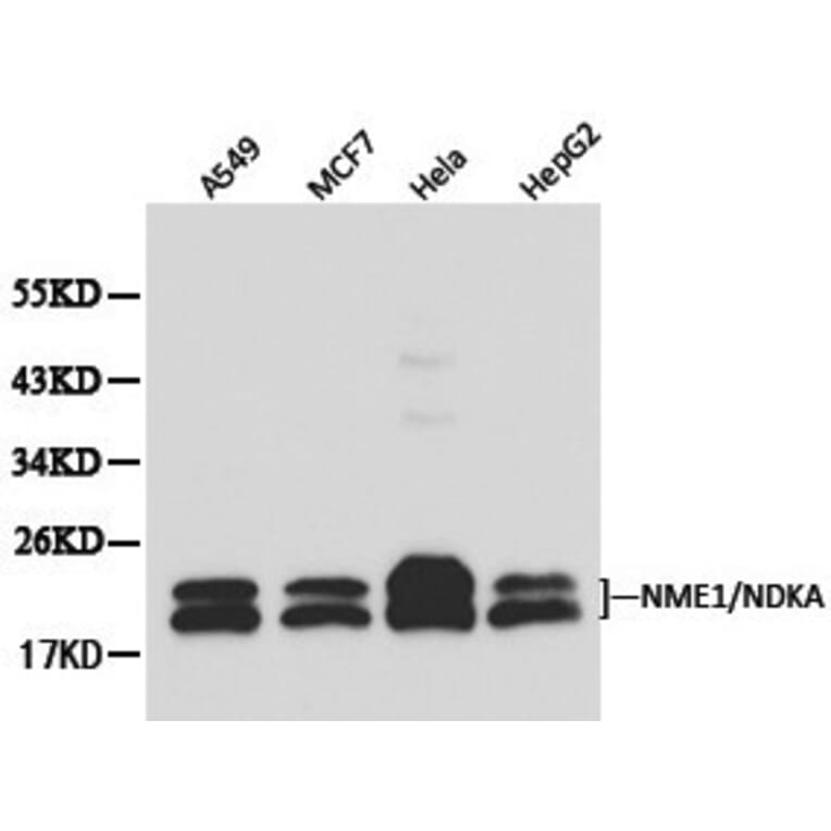 Anti-NM23-H1 (NDKA) Antibody from Bioworld Technology (BS6492) - Antibodies.com