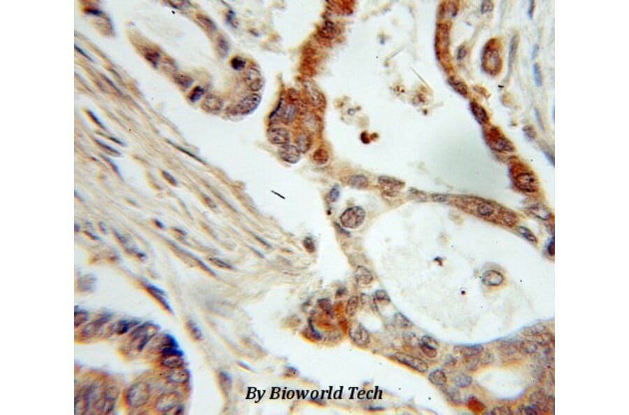 Anti-NM23-H1 (NDKA) Antibody from Bioworld Technology (BS6492) - Antibodies.com
