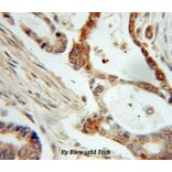 Anti-NM23-H1 (NDKA) Antibody from Bioworld Technology (BS6492) - Antibodies.com