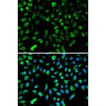 Anti-NM23-H1 (NDKA) Antibody from Bioworld Technology (BS6492) - Antibodies.com