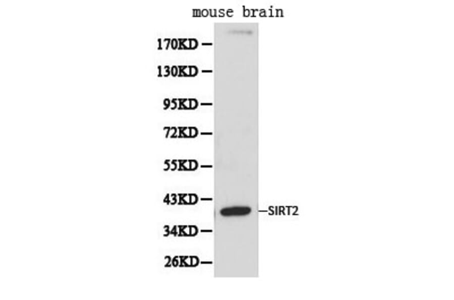 Anti-SIRT2 Antibody from Bioworld Technology (BS6495) - Antibodies.com