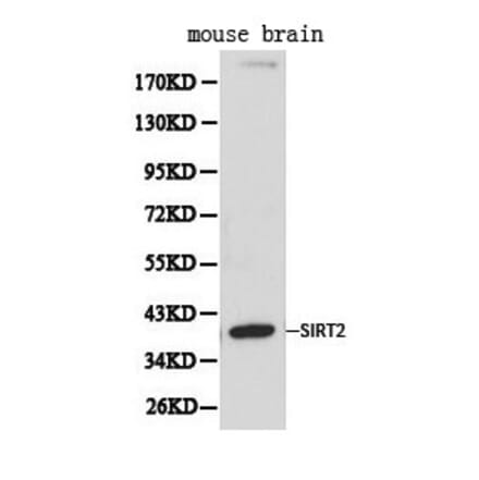 Anti-SIRT2 Antibody from Bioworld Technology (BS6495) - Antibodies.com
