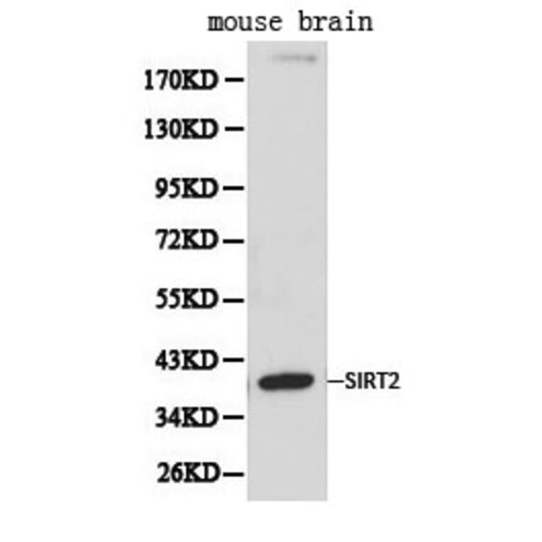 Anti-SIRT2 Antibody from Bioworld Technology (BS6495) - Antibodies.com