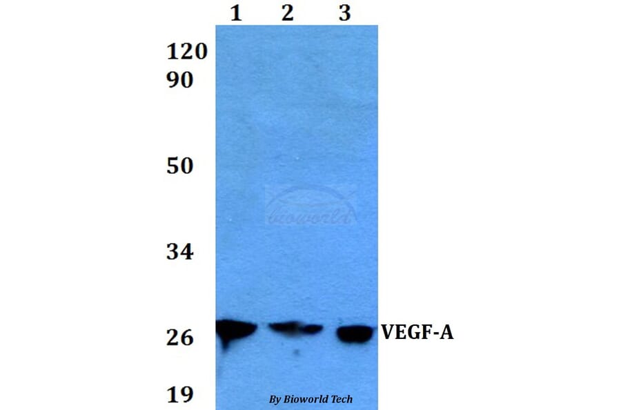Anti-VEGF-A Antibody from Bioworld Technology (BS6496) - Antibodies.com