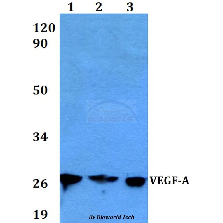 Anti-VEGF-A Antibody from Bioworld Technology (BS6496) - Antibodies.com