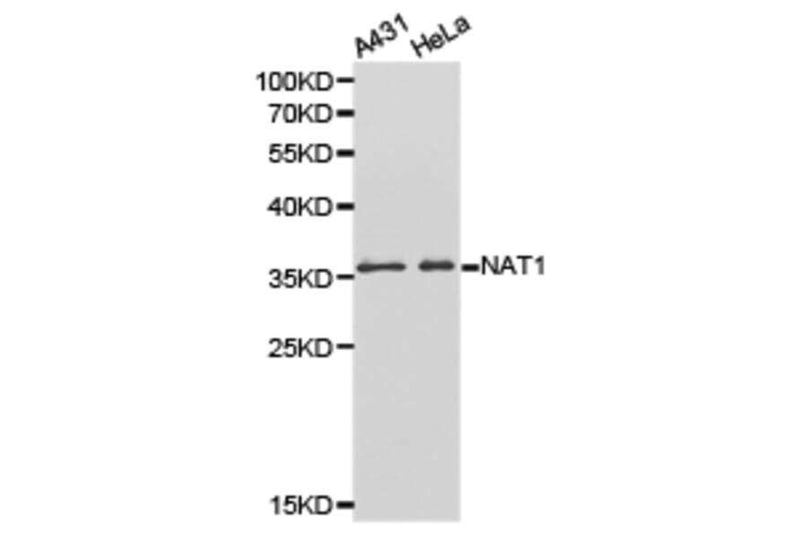 Anti-NAT1 Antibody from Bioworld Technology (BS6508) - Antibodies.com