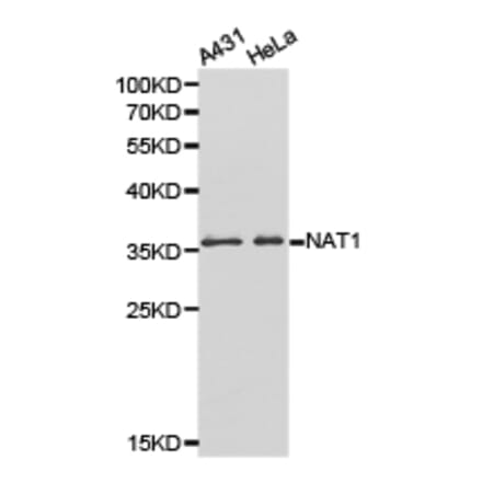 Anti-NAT1 Antibody from Bioworld Technology (BS6508) - Antibodies.com