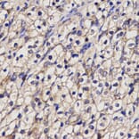 Anti-NAT1 Antibody from Bioworld Technology (BS6508) - Antibodies.com
