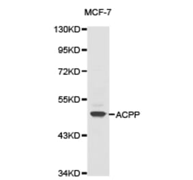Anti-ACPP Antibody from Bioworld Technology (BS6510) - Antibodies.com