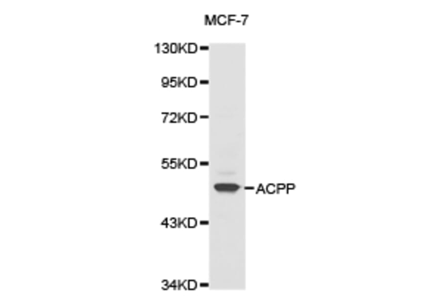 Anti-ACPP Antibody from Bioworld Technology (BS6510) - Antibodies.com