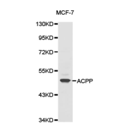Anti-ACPP Antibody from Bioworld Technology (BS6510) - Antibodies.com