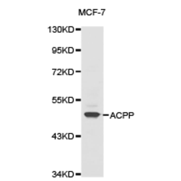 Anti-ACPP Antibody from Bioworld Technology (BS6510) - Antibodies.com