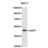 Anti-ACPP Antibody from Bioworld Technology (BS6510) - Antibodies.com
