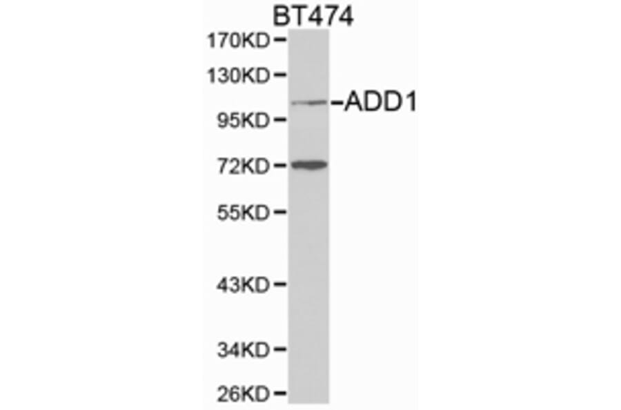 Anti-Adducin α Antibody from Bioworld Technology (BS6511) - Antibodies.com