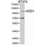 Anti-Adducin α Antibody from Bioworld Technology (BS6511) - Antibodies.com