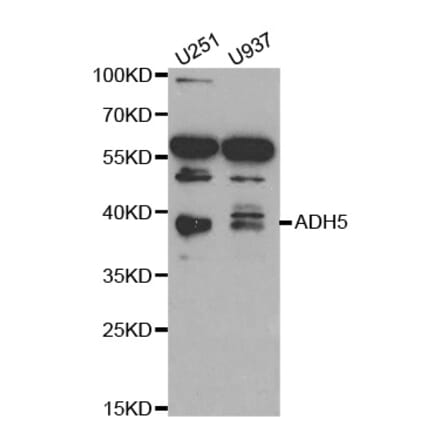 Anti-ADH5 Antibody from Bioworld Technology (BS6512) - Antibodies.com