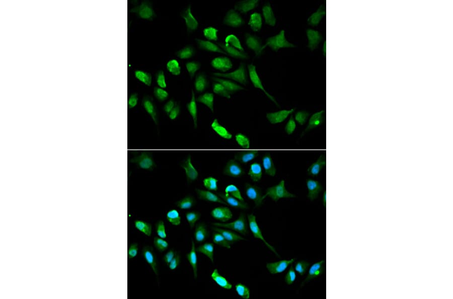 Anti-ADH5 Antibody from Bioworld Technology (BS6512) - Antibodies.com