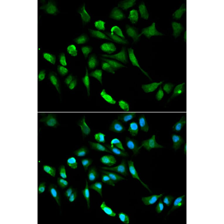 Anti-ADH5 Antibody from Bioworld Technology (BS6512) - Antibodies.com