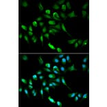 Anti-ADH5 Antibody from Bioworld Technology (BS6512) - Antibodies.com