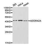 Anti-ADORA2A Antibody from Bioworld Technology (BS6513) - Antibodies.com