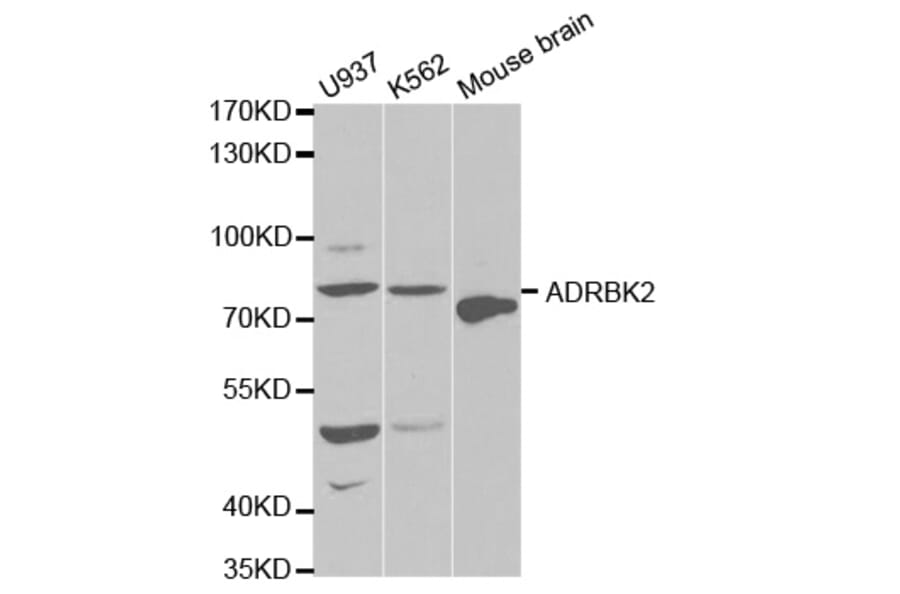 Anti-GRK 3 /ADRBK2 Antibody from Bioworld Technology (BS6514) - Antibodies.com