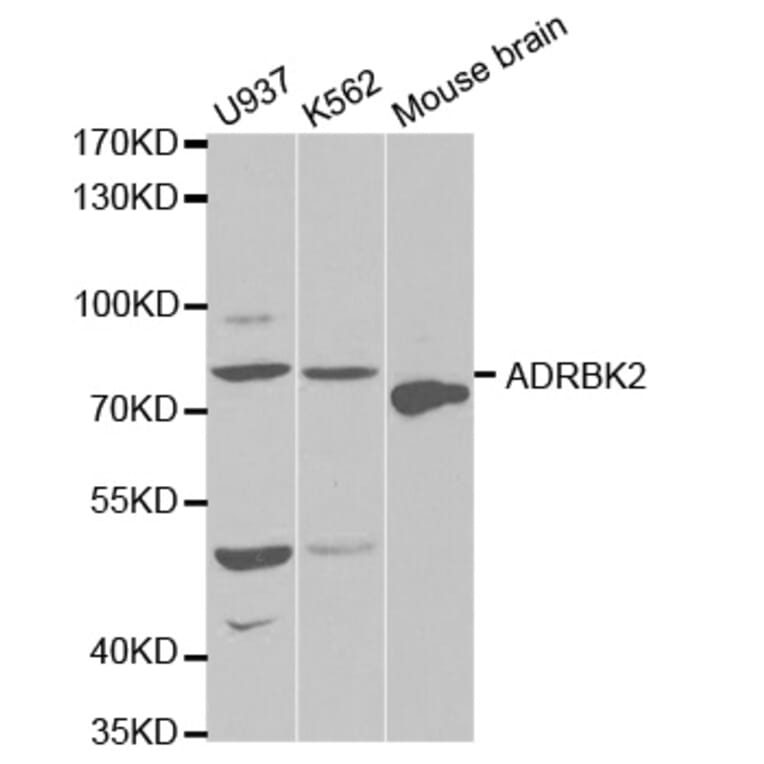 Anti-GRK 3 /ADRBK2 Antibody from Bioworld Technology (BS6514) - Antibodies.com