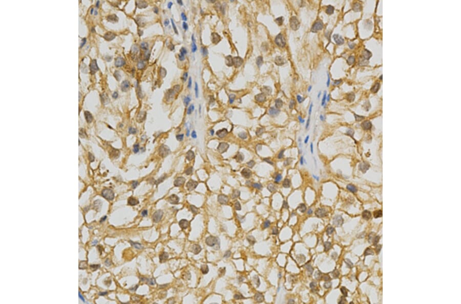 Anti-GRK 3 /ADRBK2 Antibody from Bioworld Technology (BS6514) - Antibodies.com