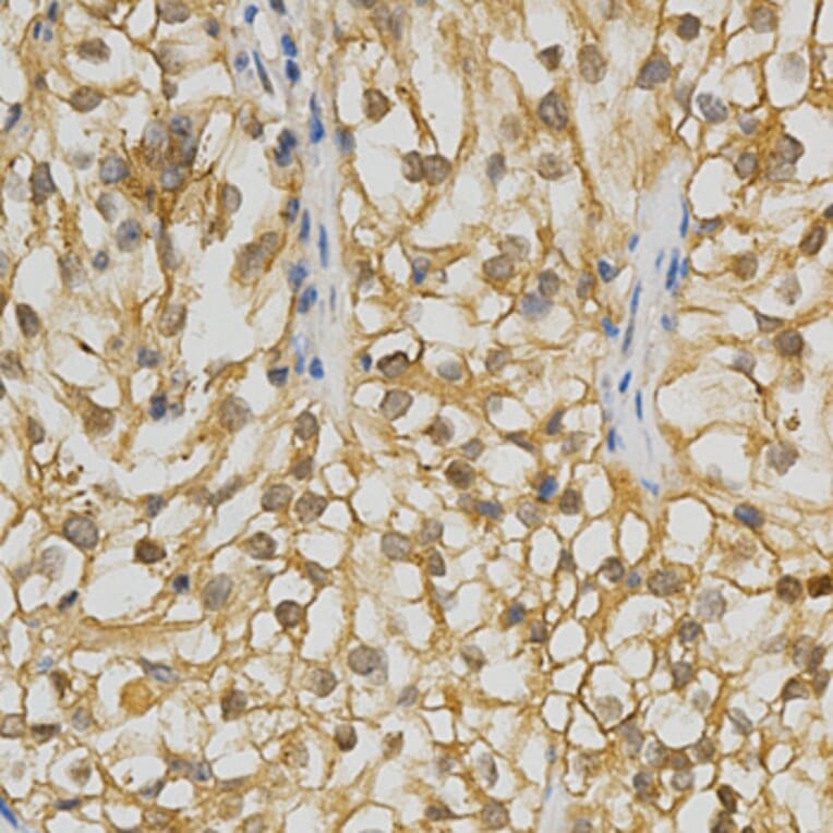Anti-GRK 3 /ADRBK2 Antibody from Bioworld Technology (BS6514) - Antibodies.com