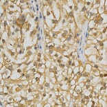Anti-GRK 3 /ADRBK2 Antibody from Bioworld Technology (BS6514) - Antibodies.com