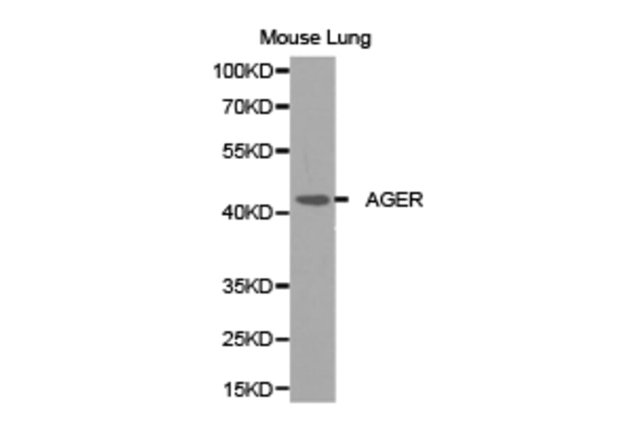 Anti-AGER Antibody from Bioworld Technology (BS6515) - Antibodies.com