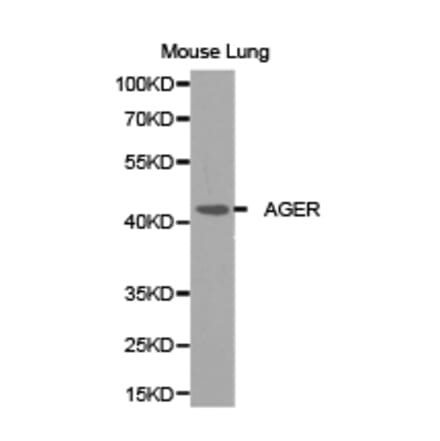 Anti-AGER Antibody from Bioworld Technology (BS6515) - Antibodies.com
