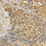 Anti-AGER Antibody from Bioworld Technology (BS6515) - Antibodies.com