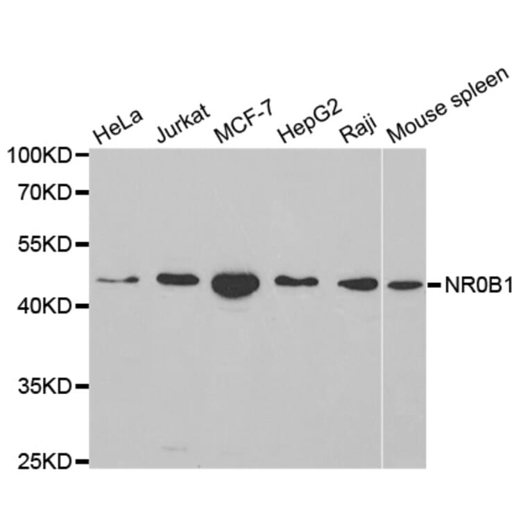 Anti-NR0B1 Antibody from Bioworld Technology (BS6516) - Antibodies.com