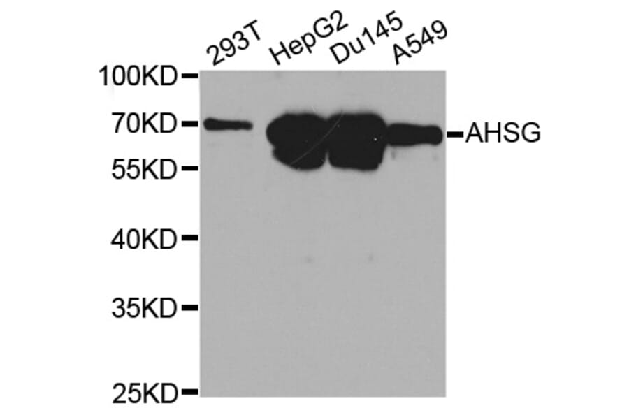 Anti-AHSG Antibody from Bioworld Technology (BS6517) - Antibodies.com