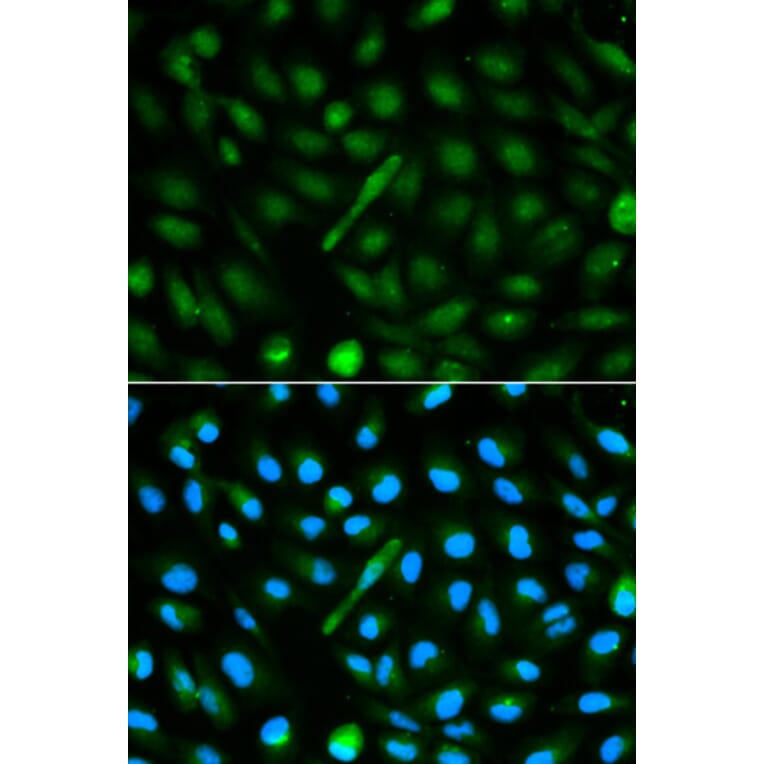 Anti-AHSG Antibody from Bioworld Technology (BS6517) - Antibodies.com