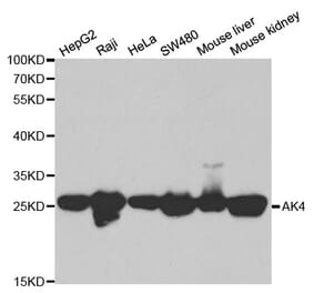 Anti-AK4 Antibody from Bioworld Technology (BS6519) - Antibodies.com