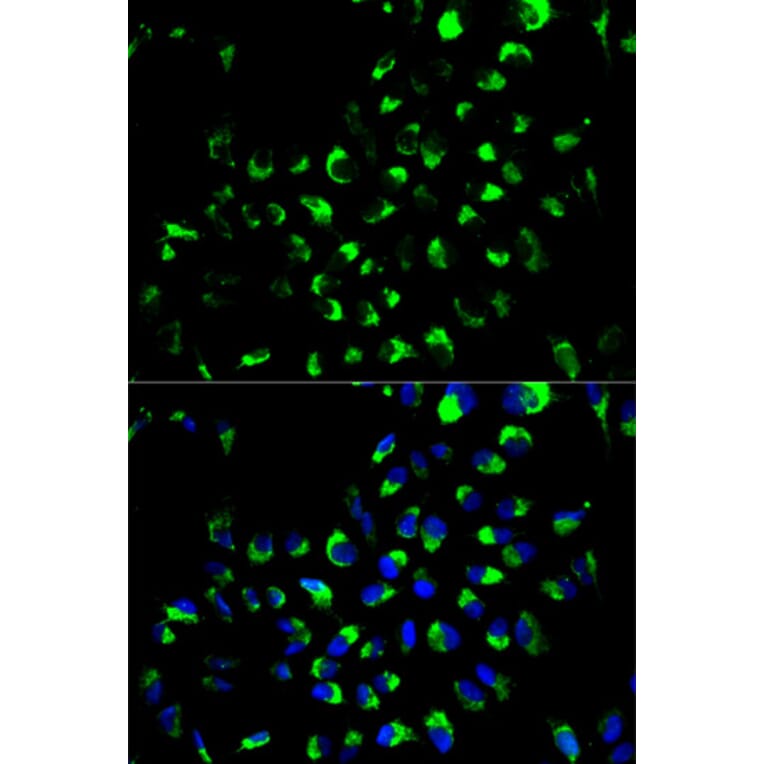 Anti-AK4 Antibody from Bioworld Technology (BS6519) - Antibodies.com