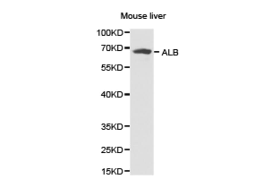 Anti-Albumin Antibody from Bioworld Technology (BS6520) - Antibodies.com